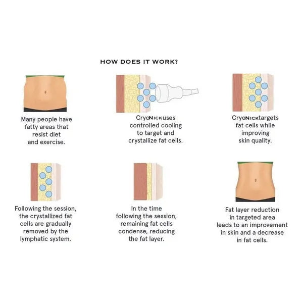 Cryonick Factory CryoStar Iceberg Cryonick Roller Mini- Body Shaper