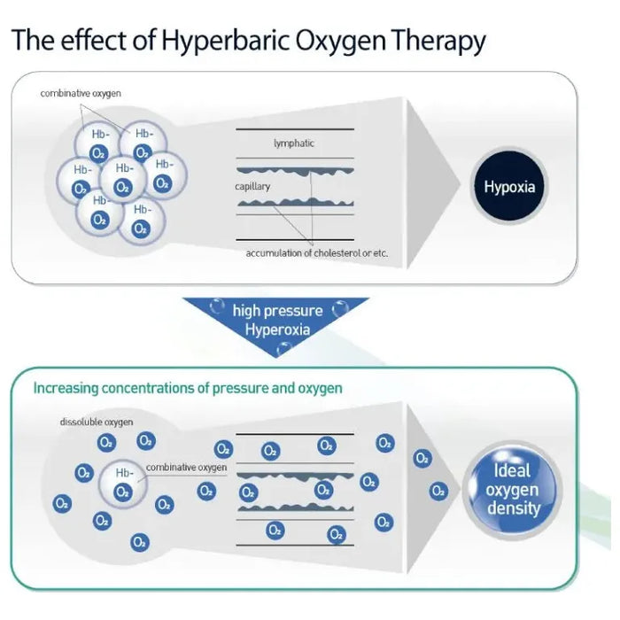 40D Hyperbaric Oxygen Chamber Hard Shell 2.5 ATA