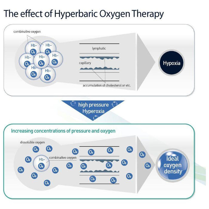 Oxygen Health Systems 34D Hyperbaric Oxygen Chamber Hard Shell 1.5 ATA