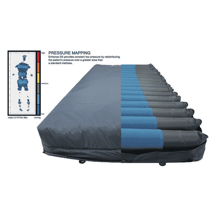 Prius Healthcare - Enhance DX Micro LAL/AP Mattress Replacement System
