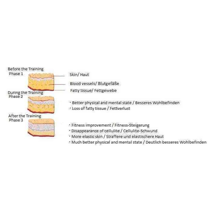 Cryonick Factory CryoStar InfraRunick Infrared Therapy Treadmill